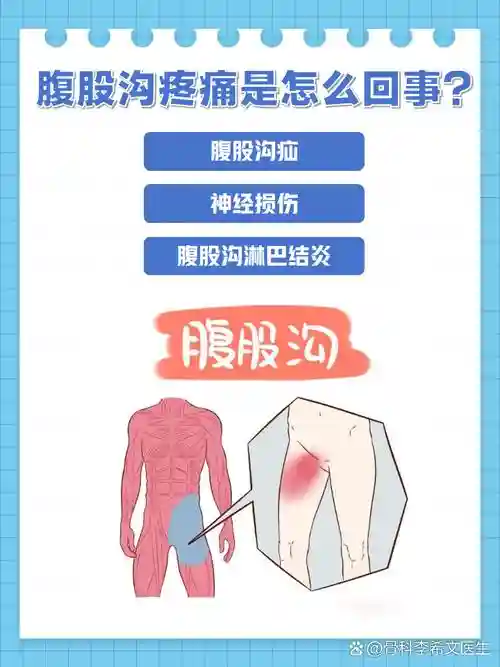 复购阵容插图1